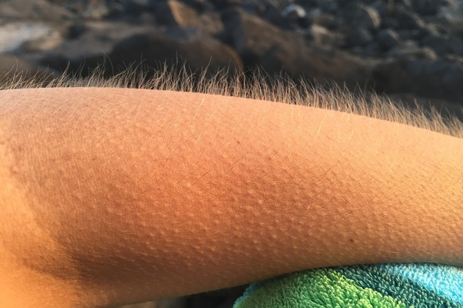 Названо новое неожиданное последствие омикрона