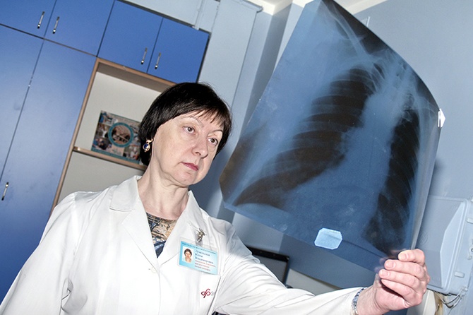 Повышенный риск рака легких у курильщиков сохраняется еще 10-15 лет после отказа от привычки