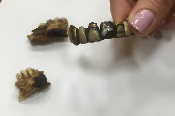 Правозащитница Ева Меркачева показала зубы Адольфа Гитлера, хранящиеся в архиве ФСБ