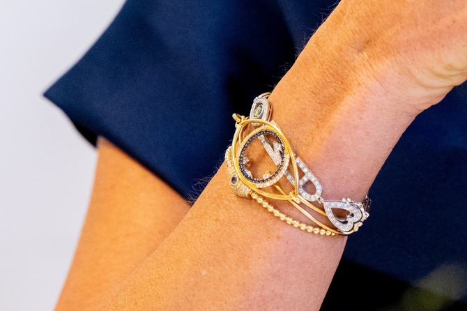 Врач рассказал, на какие украшения может быть аллергия