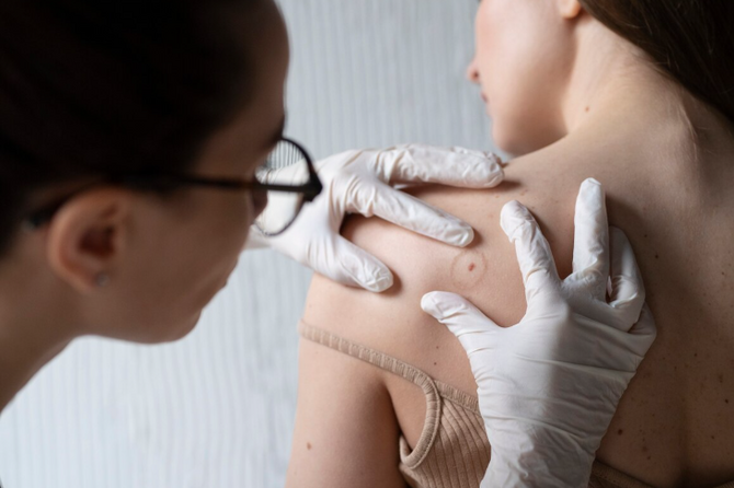 Врач рассказала об опасности вируса папилломы человека