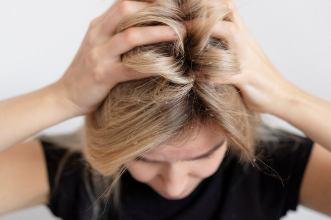 Врач назвала неожиданные опасности редкого мытья головы