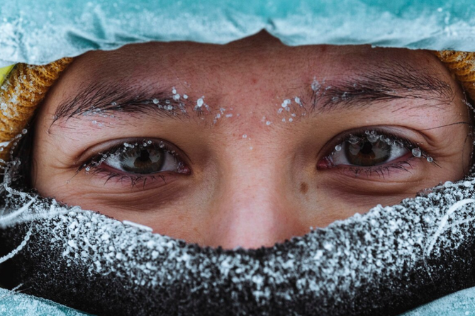 Врач рассказала о самых частых проблемах со зрением в зимний период 