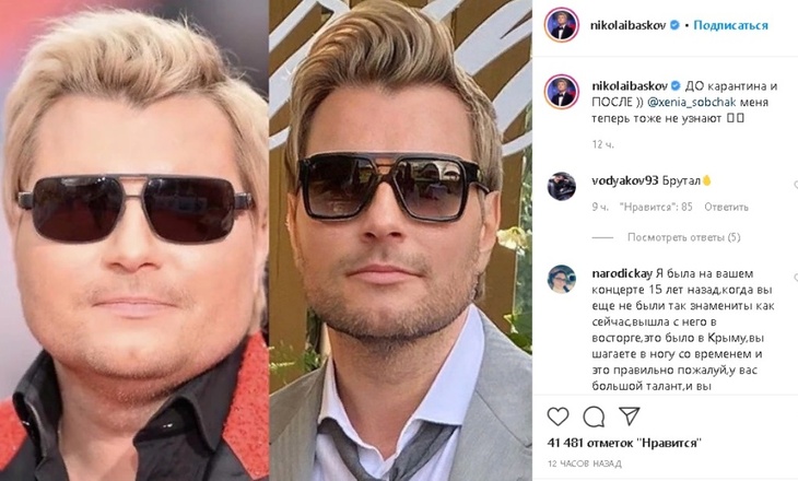 «До и после» Николая Баскова: артист показал свои перемены