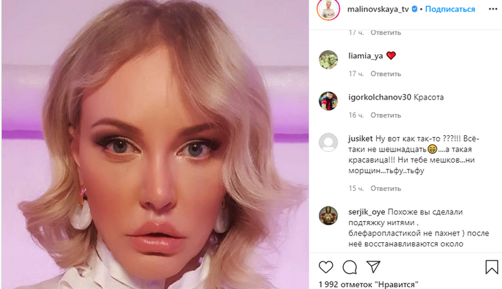 «Глаза-то закрываются?»: Малиновская шокировала результатом пластики 