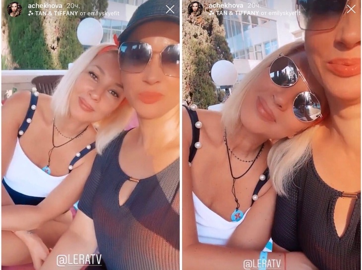 Кудрявцева засветила грудь впервые после удаления имплантов 