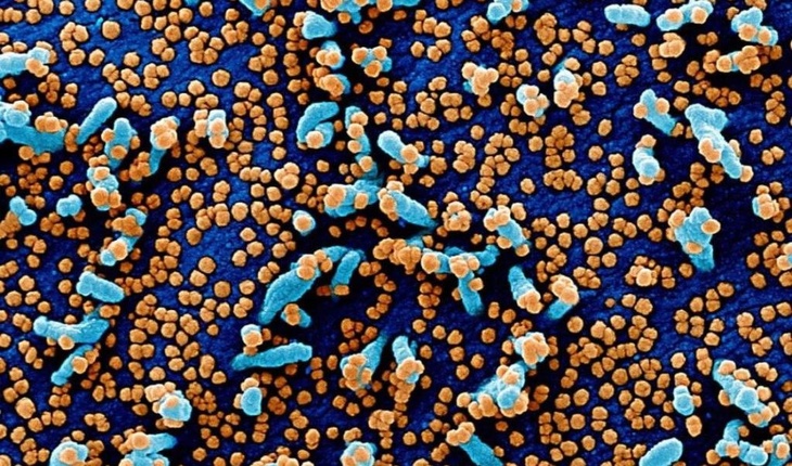 Инфекционисты показали фото нового коронавируса