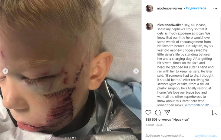 90 швов: шестилетний мальчик спас сестренку от собаки