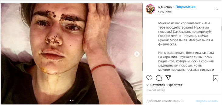 «Честно – помощь нужна»: звезду «Дома-2» и «Битвы экстрасенсов» избили