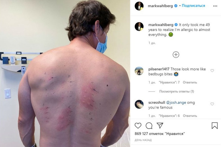 У Марка Уолберга оказалась аллергия на жизнь