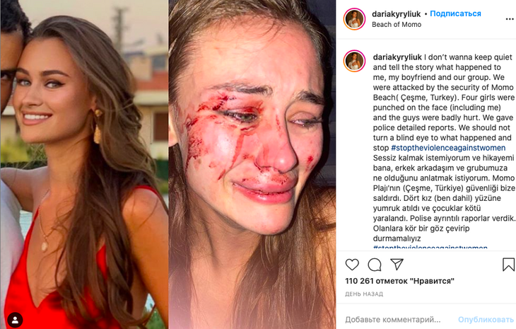 Украинскую топ-модель жестоко избили на турецком пляже 