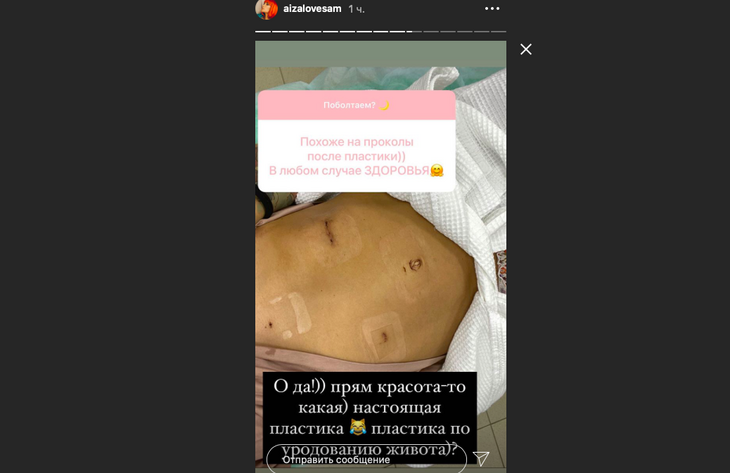 «Дикая жалость к себе»: Айзе удалили опухоль желудка 
