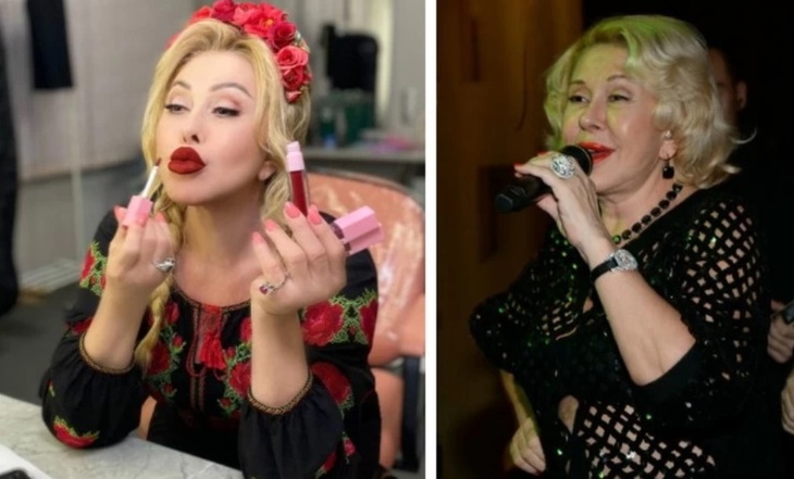 Фотошоп к лицу: как на самом деле выглядят российские звезды