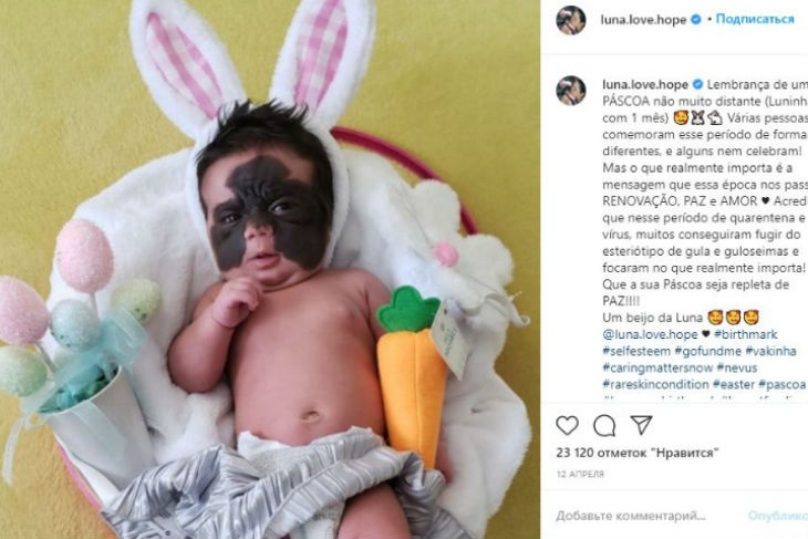 Мама девочки с «маской Бэтмена» показала результаты очередной операции