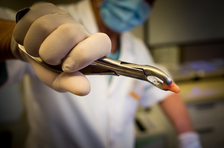 Профсоюз предупредил, что россияне могут остаться без стоматологов