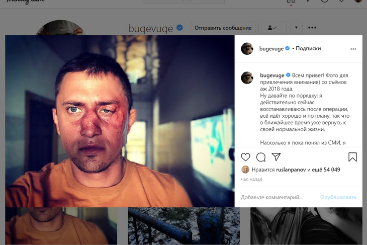 «Версия интереснее правды»: Прилучный лично прокомментировал избиение