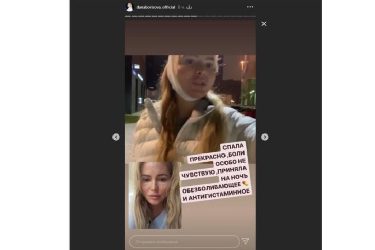 Дана Борисова показала перекроенное лицо