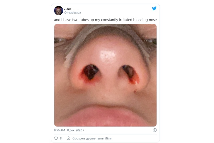 «Установлены две трубки»: дочери Гузеевой сделали операцию на лице