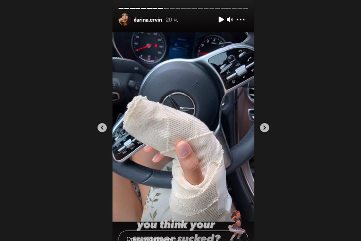 «Это могла быть только правая рука»: эффектная жена Цекало оказалась на операционном столе