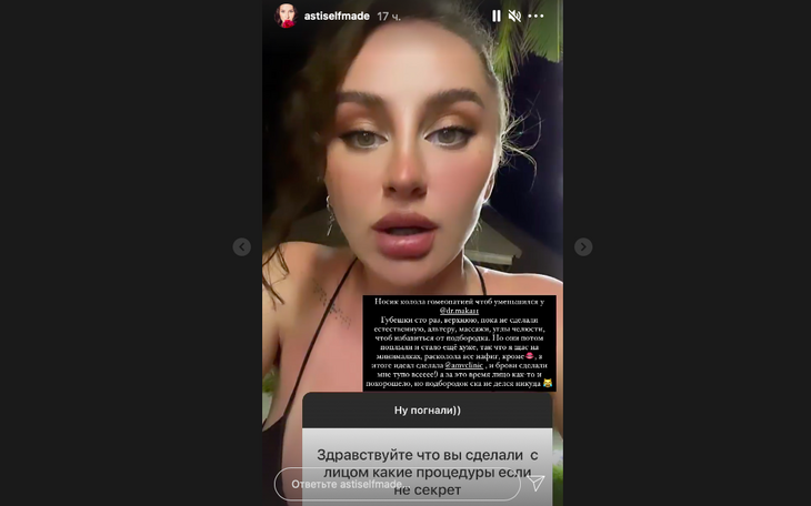 «Губешки сто раз»: Asti раскрыла количество своих пластических операций 