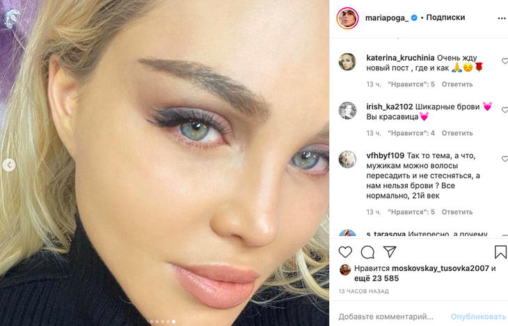 «Выгляжу офигенно»: Погребняк похвасталась результатом пересадки бровей