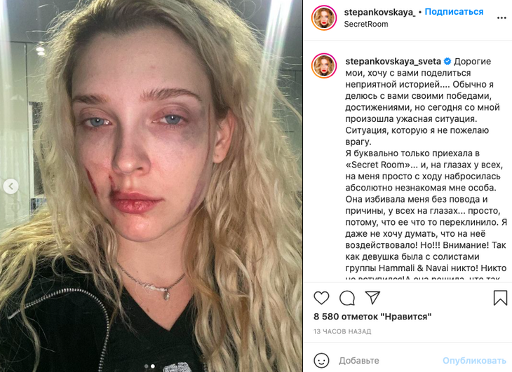 «На глазах у всех»: экс-солистку «Мобильных блондинок» жестоко избили в ночном клубе 