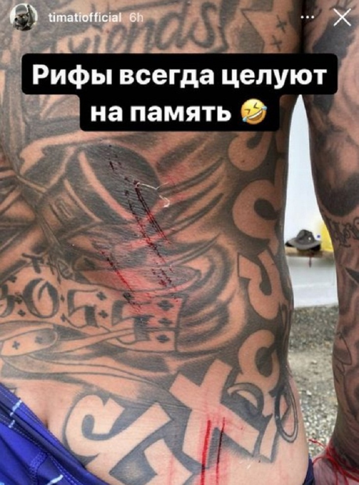 Поцелуй на память: Тимати поранился по время серфинга на Мальдивах