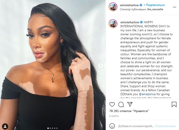 Пришло время: Регина Тодоренко рассказала о неизлечимой болезни