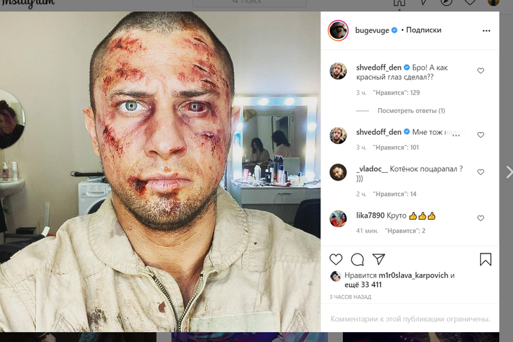 «Котенок поцарапал?»: Прилучный шокировал снимком окровавленного лица