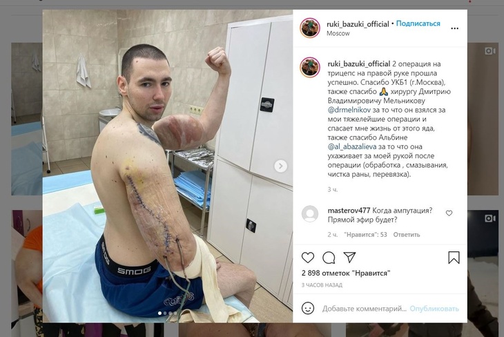 «Когда ампутация?»: «Руки-базуки» перенес вторую операцию по удалению синтола
