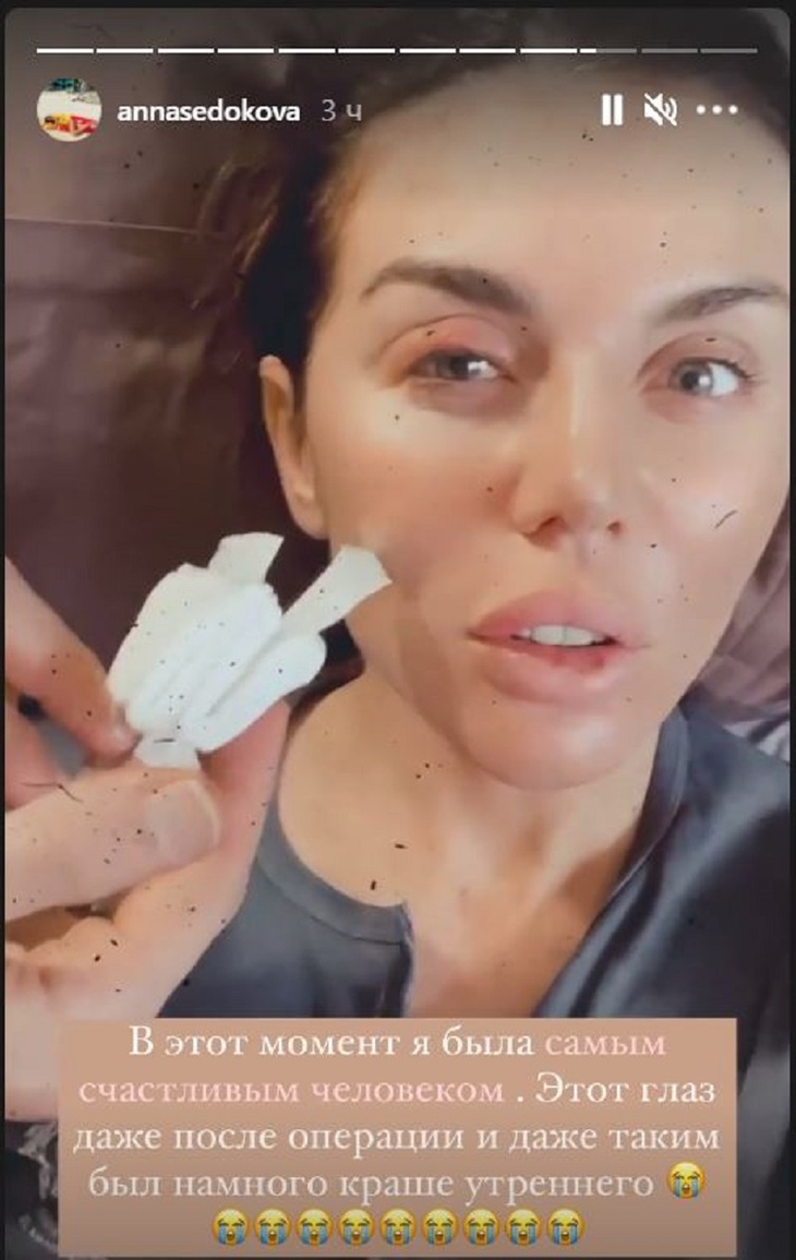 «Было очень страшно»: Седокова показала, как выглядит ее глаз после экстренной операции