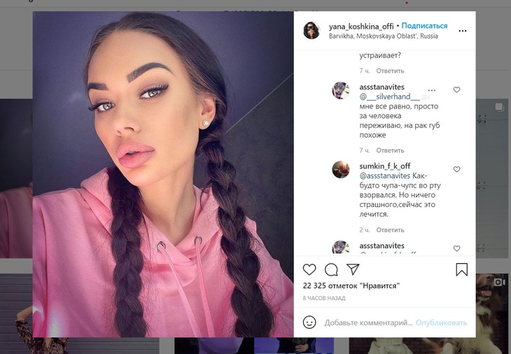 «Скоро губищи полопаются»: новое селфи Кошкиной возмутило подписчиков