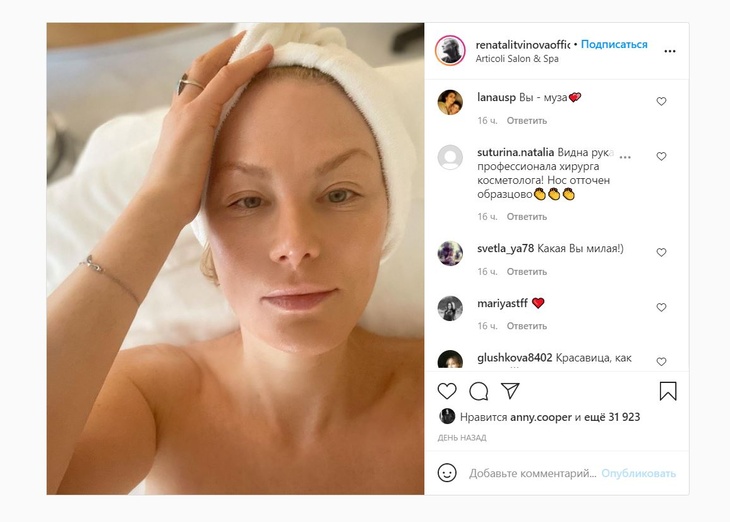 «Отточен образцово!»: Литвинову заподозрили в пластике носа «Отточен образцово!»: Литвинову заподозрили в пластике носа