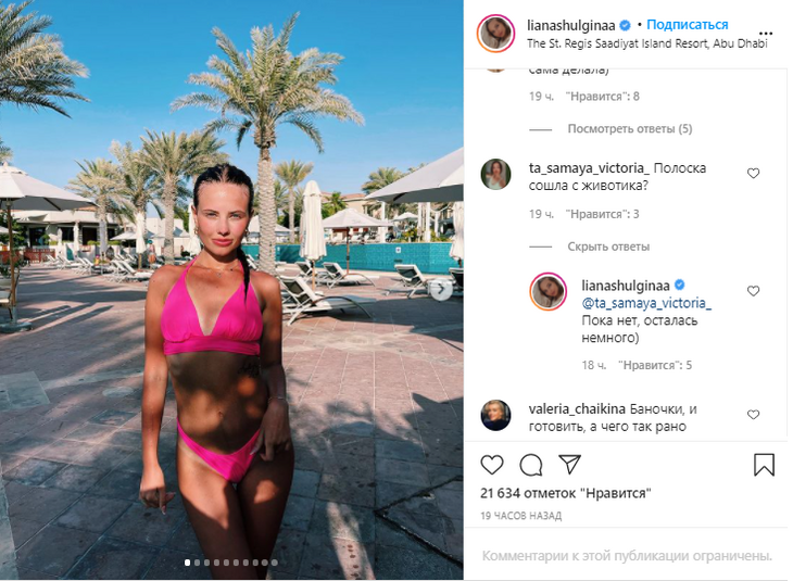 «Полоска на животике осталась»: невестка Валерии показала фигуру в купальнике после родов