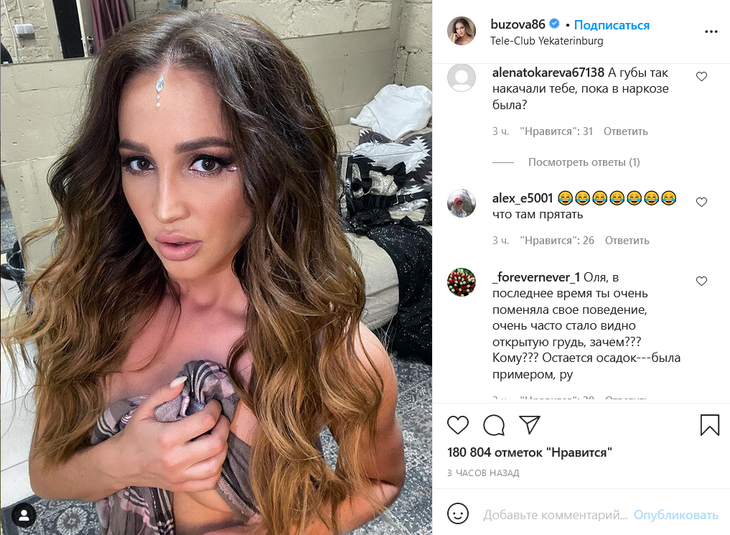 «Губы накачали, пока в наркозе была?»: Бузову подозревают в пластических операциях