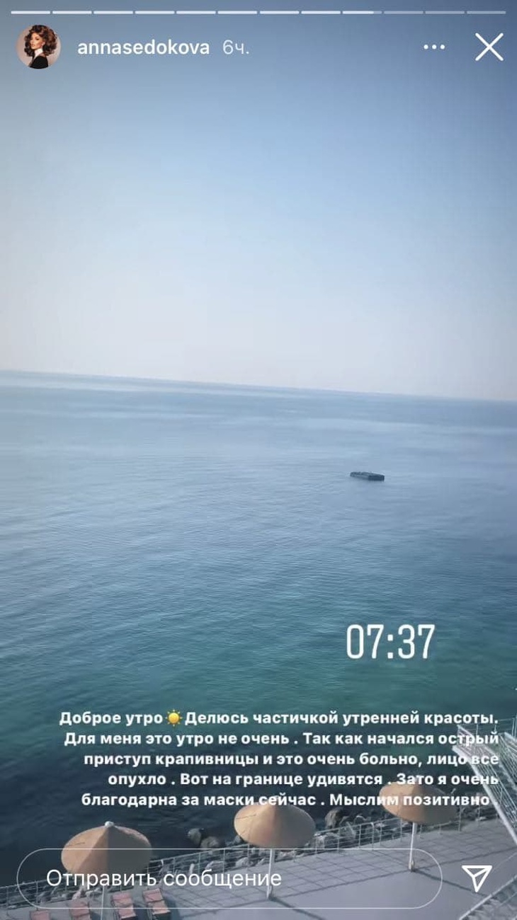 «Вот на границе удивятся»: у Седоковой опухло лицо после визита в Одессу