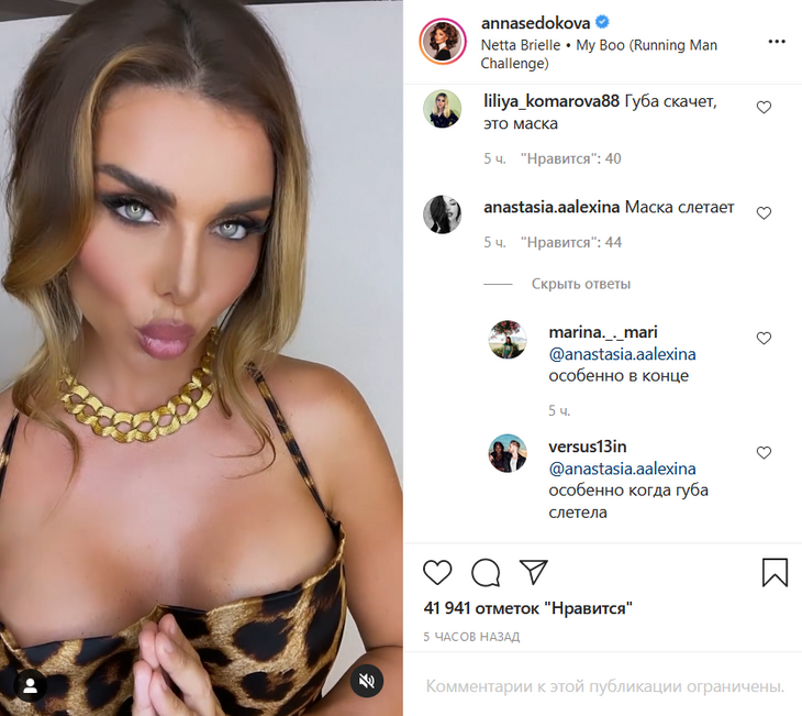 «Губа скачет, это маска»: фанаты заметили, что в клипе у Седоковой слетают фильтры