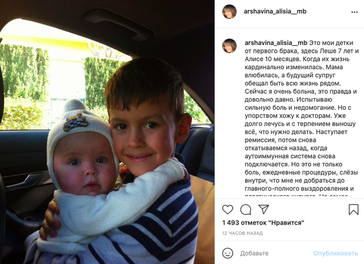 «Лопнула кожа»: тяжелобольная экс-жена Аршавина пожаловалась на новую беду