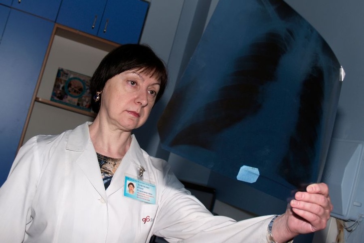 Опыт врачей: какие неожиданные симптомы могут указывать на рак легких