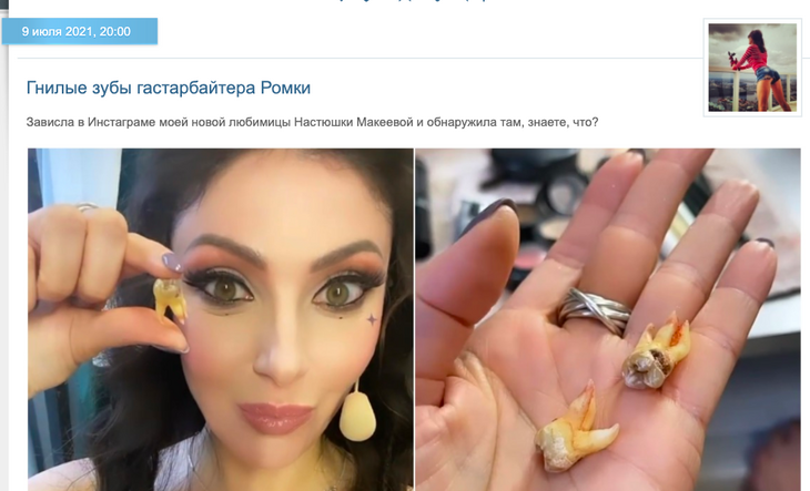 «Готова эту помойку облизывать языком»: Макеева показала гнилые зубы Малькова