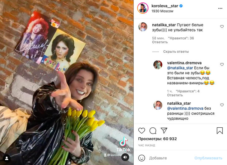 «Смотрится чудовищно»: Королева ужаснула поклонников зубами «цвета унитаза»