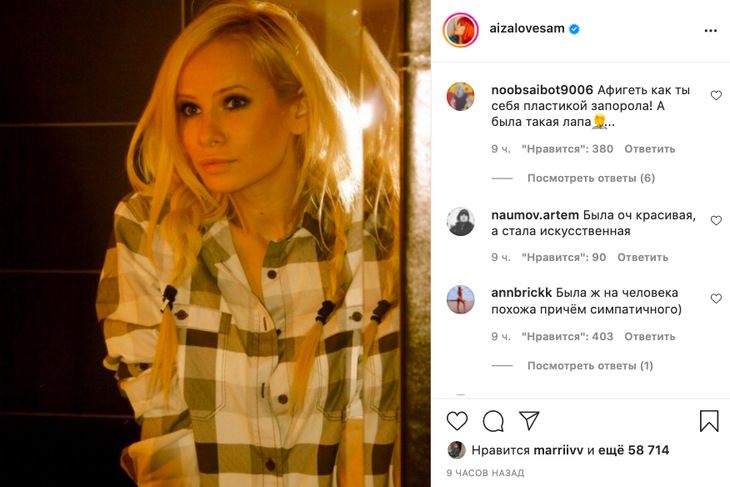 Айза Долматова показала себя до пластики