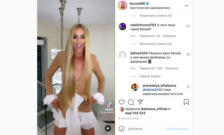 «Заразы нахваталась»: Бузова испугала поклонников неестественно белым языком