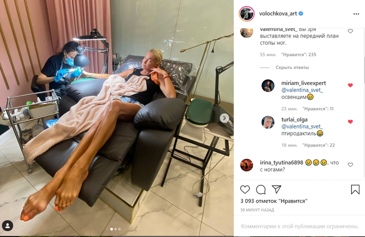 «Доктор, помогите!»: Волочкова напугала поклонников «куриными лапками» «Доктор, помогите!»: Волочкова напугала поклонников «куриными лапками»
