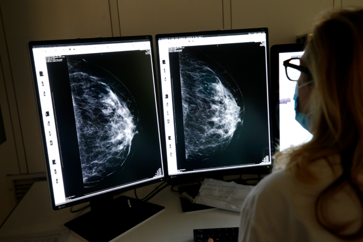 Врач объяснил, как вовремя выявить рак груди