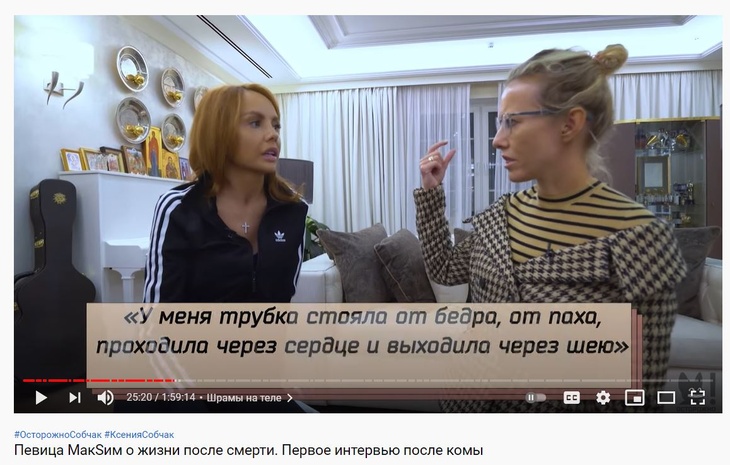 Певица МакSим показала шрамы после двух месяцев в коме