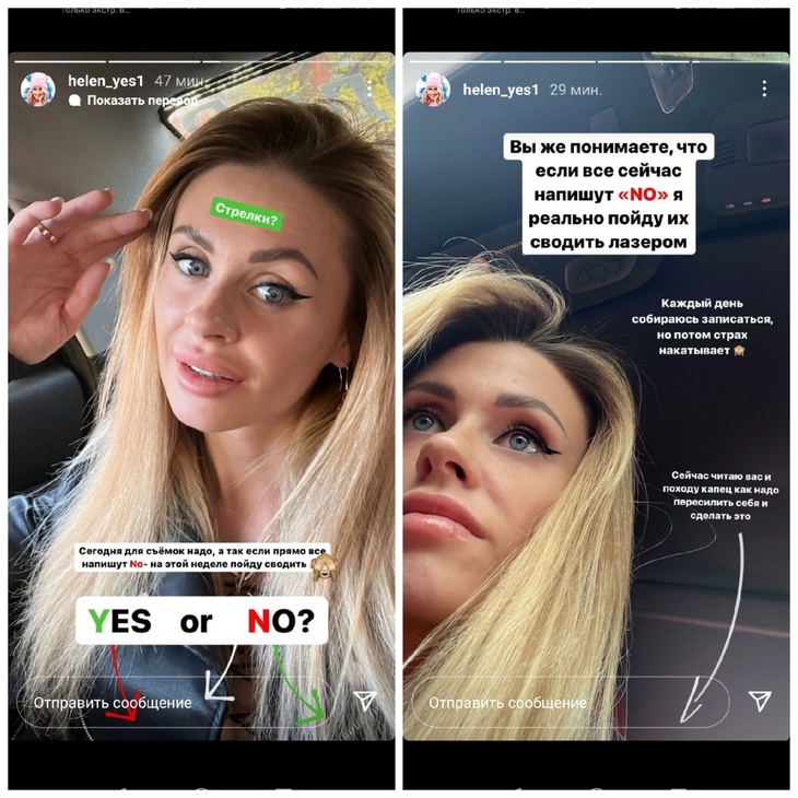 Блогер Елена Сажина будет терпеть адскую боль ради красоты на лице
