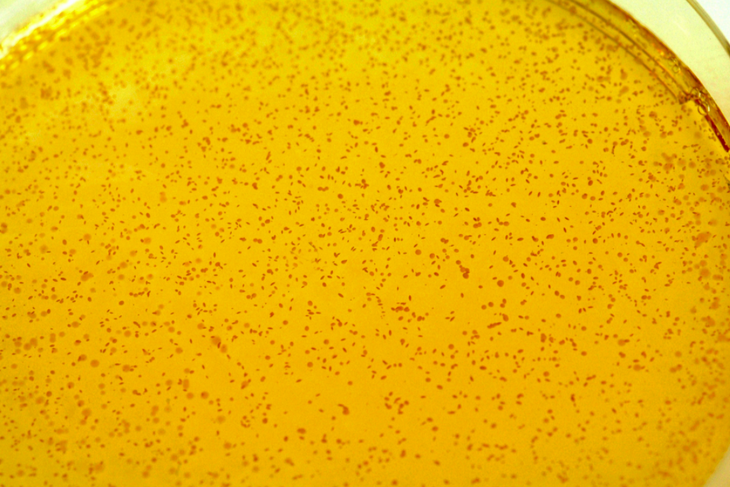 Ученые рассказали о пользе косметики с лактобактериями