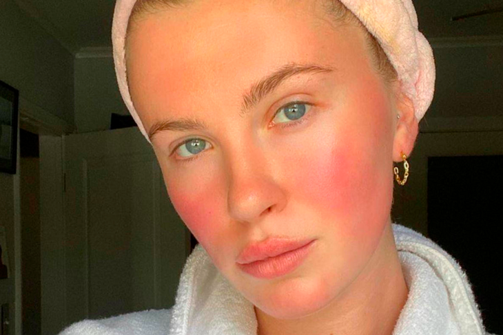 Как предупредить и замаскировать купероз Как предупредить и замаскировать купероз