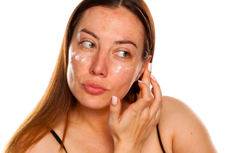 Визажист рассказал, как делать макияж на коже с акне